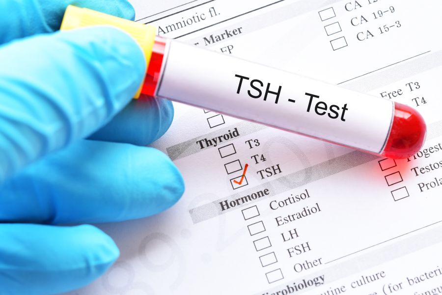 TSH norma - badanie tarczycy