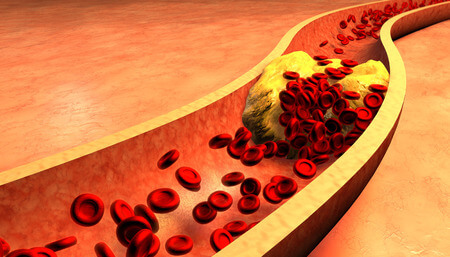 cholesterol układ krwionośny