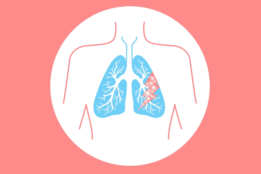 Jak rozpoznać zapalenie płuc?