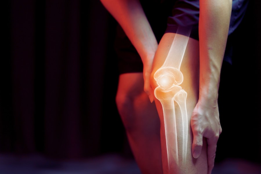 Zbliżenie na kolano sportowca z uwidocznionym stanem zapalnym stawu kolanowego.
