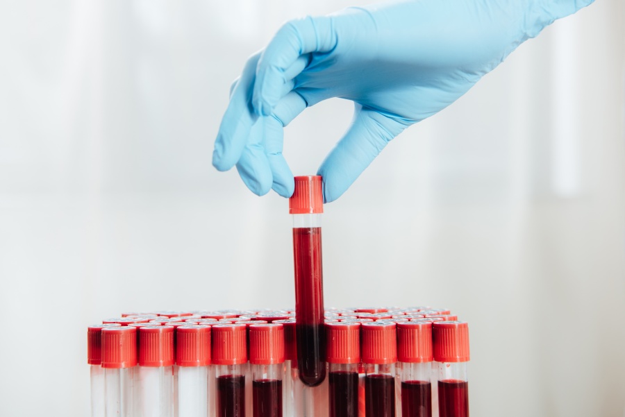 Morfologia – podstawowe badanie krwi
