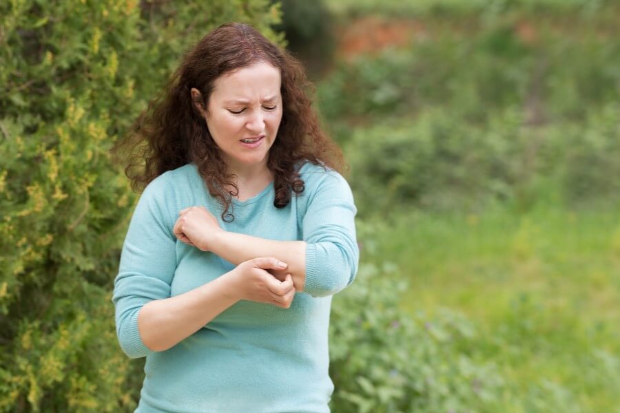 Kobieta ze swędzącą wysypką alergiczną na ręce.