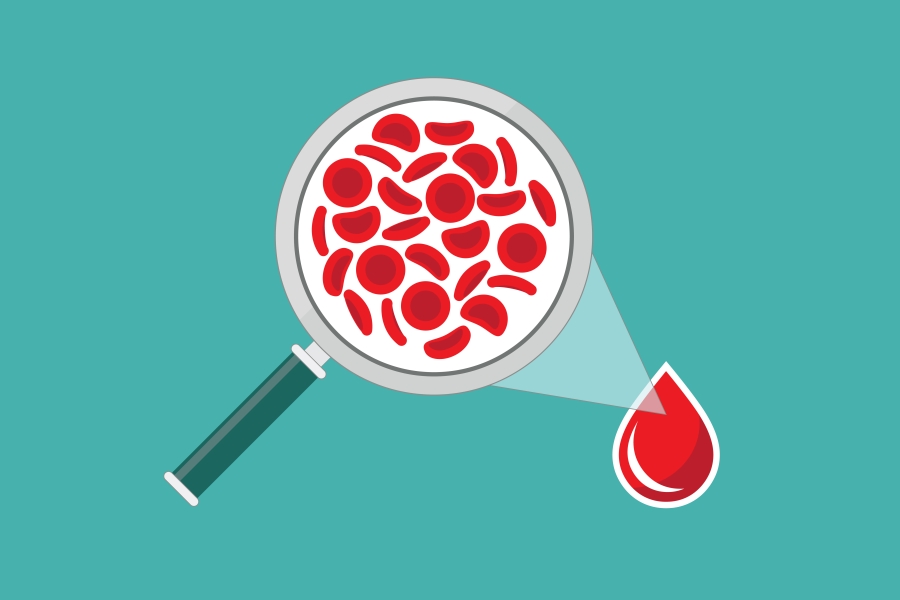 Jak diagnozować anemię?