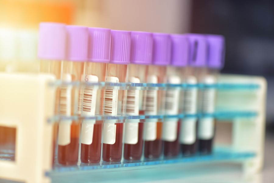 Próbki krwi pacjentów przeznaczone m.in. do badania stężenia mioglobiny.