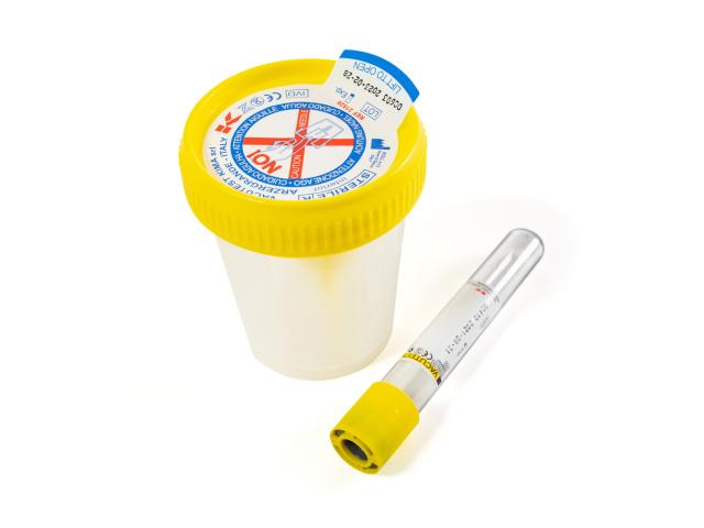 Vacutest Zestaw do pobierania próbki moczu 60 ml sterylny próżniowy interakcje ulotka pojemnik 1 op.